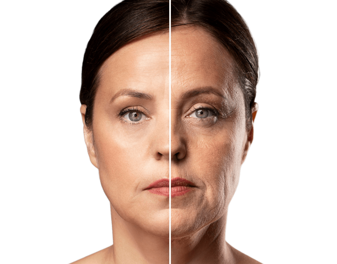 درمان چین و چروک در زیبایی دکتر پاردس