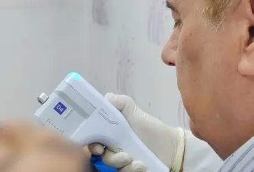 درمان لکه های تیره پوست دکتر پاردس