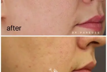 قبل و بعد از عمل زیبایی دکتر پاردس