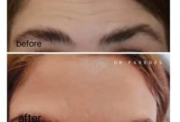 قبل و بعد از عمل زیبایی دکتر پاردس