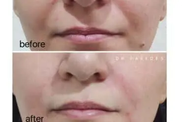 قبل و بعد از عمل زیبایی دکتر پاردس