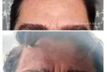 قبل و بعد از عمل زیبایی دکتر پاردس