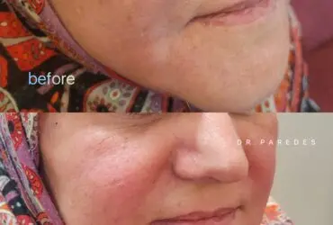 قبل و بعد از عمل زیبایی دکتر پاردس