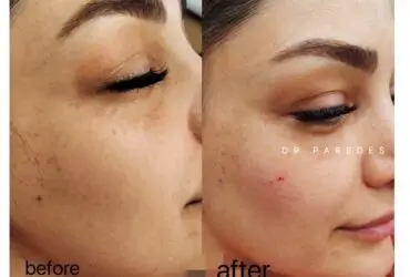 قبل و بعد از عمل زیبایی دکتر پاردس