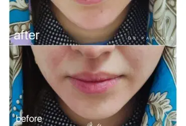 قبل و بعد از عمل زیبایی دکتر پاردس