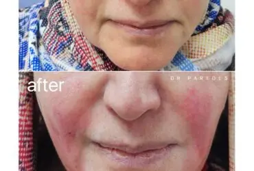 قبل و بعد از عمل زیبایی دکتر پاردس
