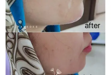 قبل و بعد از عمل زیبایی دکتر پاردس