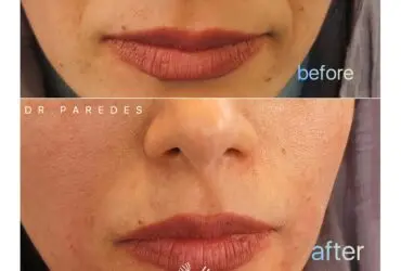 قبل و بعد از عمل زیبایی دکتر پاردس