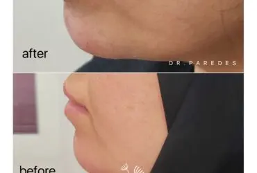 قبل و بعد از عمل زیبایی دکتر پاردس