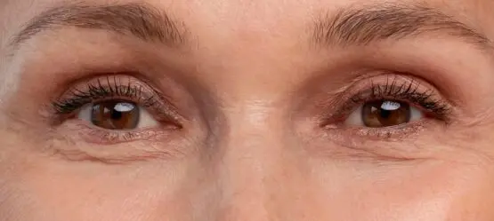 بعد از عمل زیبایی دکتر پاردس