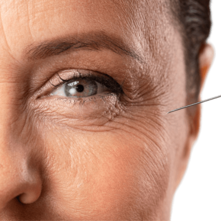 بوتاکس​ دکتر پاردس